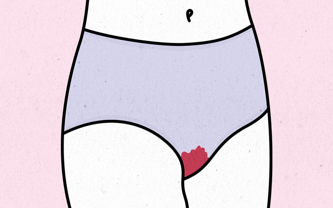 Opinion: The media shies away from the topic of menstruation. Enough is enough